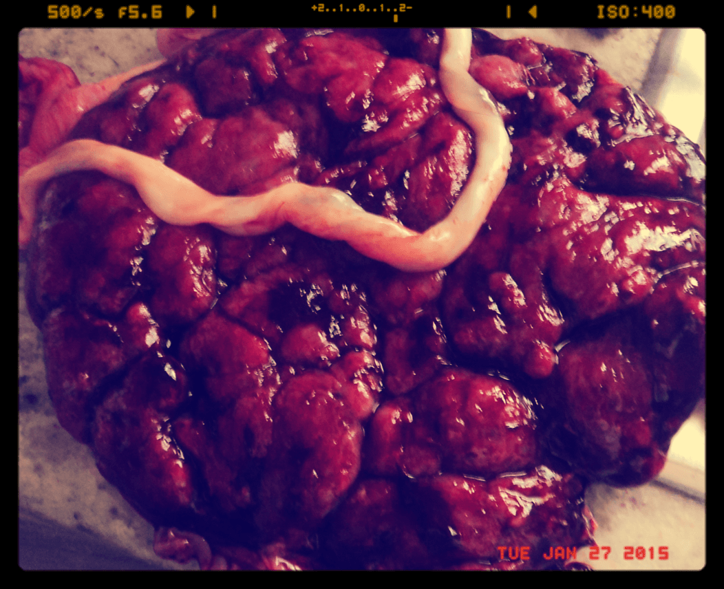 La Placenta; El Árbol de la vida que acaba en un cubo de basura.